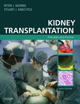 Kidney Transplantation