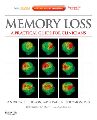 Memory Loss