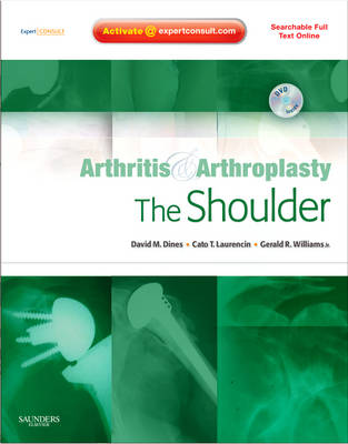 Arthritis and Arthroplasty: The Shoulder