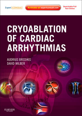 Cryoablation of Cardiac Arrhythmias