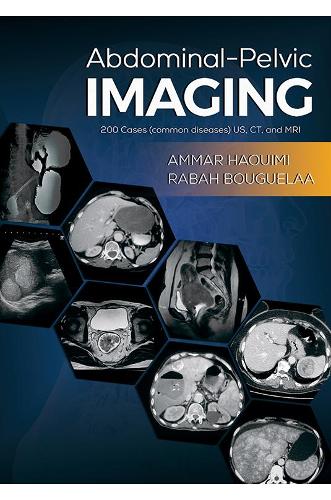 Abdominal-Pelvic Imaging