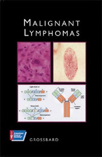 MALIGNANT LYMPHOMAS
