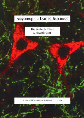 Amytrophic Lateral Sclerosis