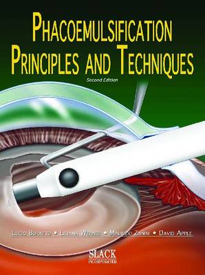 Phacoemulsification