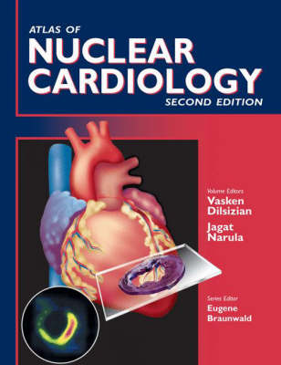 Atlas of Nuclear Cardiology 2006