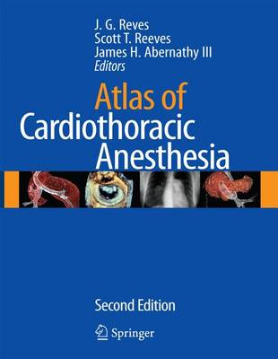 Atlas of Anesthesia