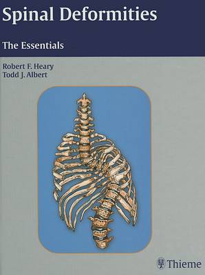 Spinal Deformities