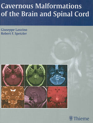 Cavernous Malformations of the Brain and Spinal Cord