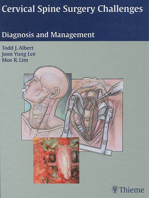 Cervical Spine Surgery Challenges