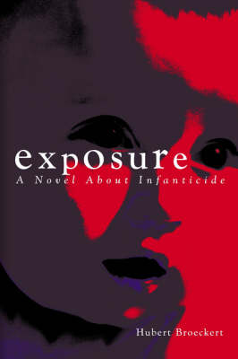 Exposure