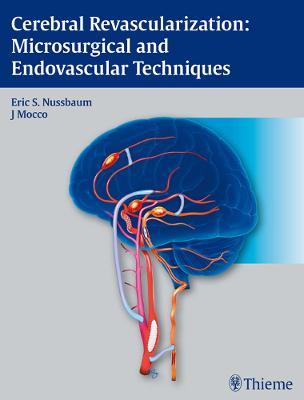 Cerebral Revascularization: Microsurgical and Endovascular Techniques
