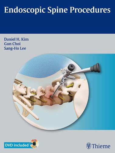 Endoscopic Spine Procedures
