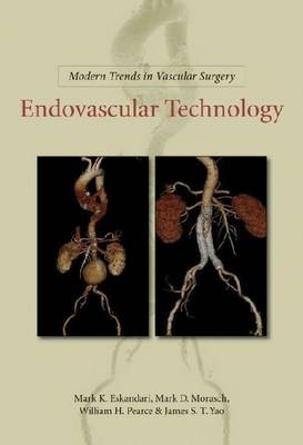 Modern Trends in Vascular Surgery: Endovascular Technology