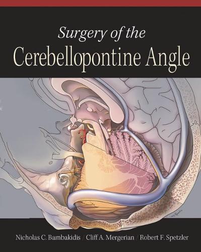 Surgery of the Cerebellopontine Angle