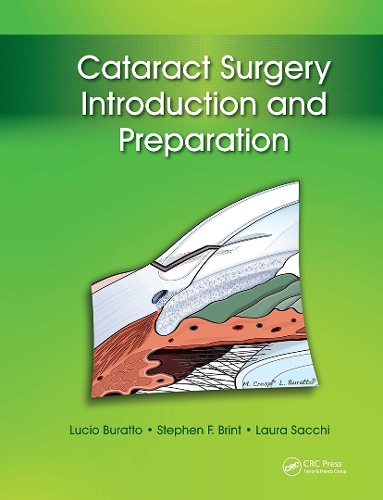 Cataract Surgery