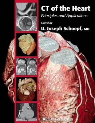 CT of the Heart