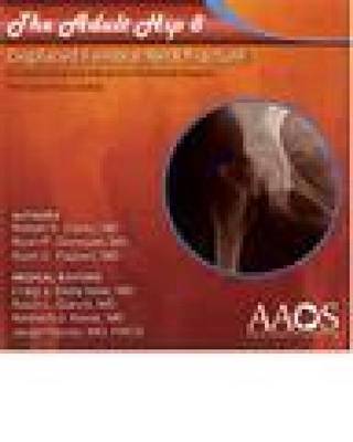 The Adult Hip 8: Displaced Femoral Neck Fracture