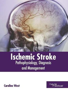 Ischemic Stroke: Pathophysiology, Diagnosis and Management