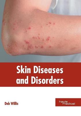 Skin Diseases and Disorders