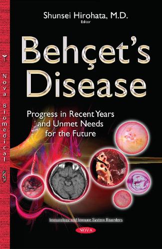 Behçets Disease