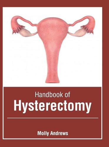 Handbook of Hysterectomy