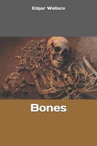 Bones
