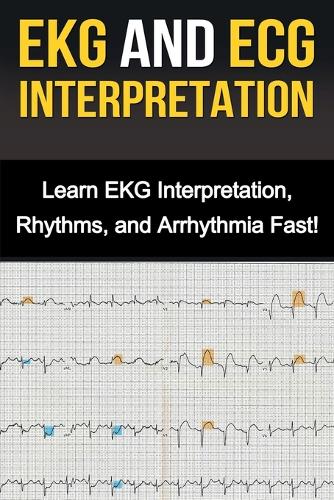 EKG and ECG Interpretation