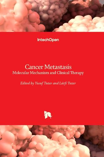 Cancer Metastasis