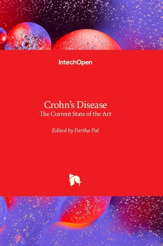 Crohn’s Disease
