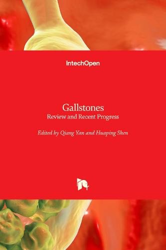 Gallstones