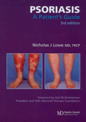 Psoriasis