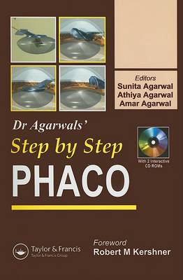 Step by Step Phacoemulsification