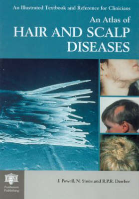Atlas of Hair and Scalp Diseases