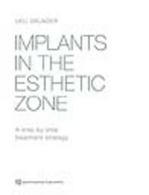 Implants in the Esthetic Zone