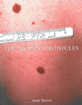 Mole Chronicles