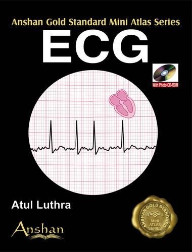 Mini Atlas of  ECG
