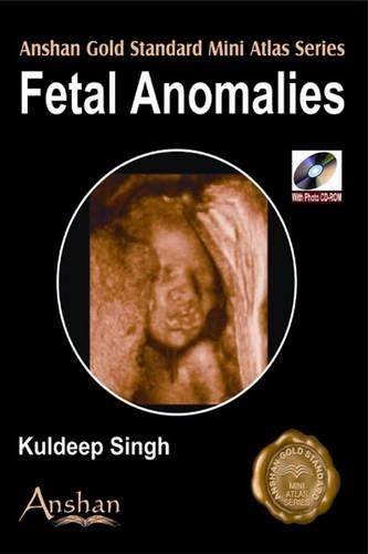 Mini Atlas of Fetal Anomalies