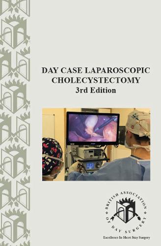 Day Case Laparoscopic Cholecystectomy