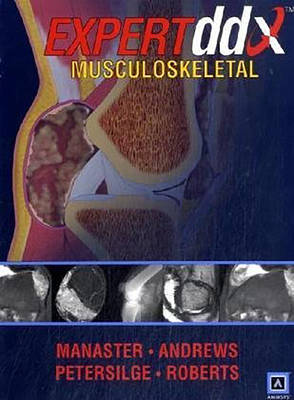 EXPERTddx: Musculoskeletal