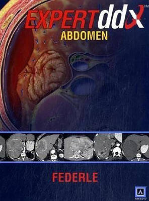 EXPERTddx: Abdomen