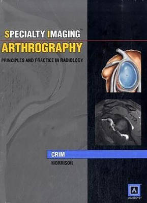 Specialty Imaging: Arthrography