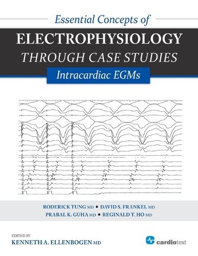 Essential Concepts of Electrophysiology Through Case Studies: Intracardiac EGMs