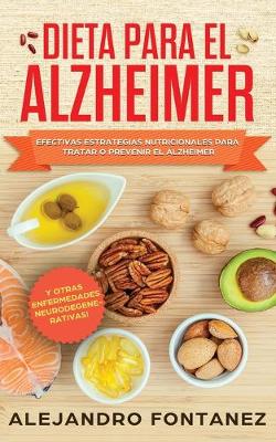 Dieta para Alzheimer