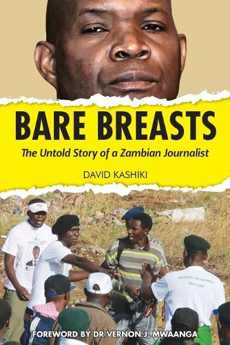 Bare Breasts