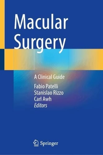 Macular Surgery