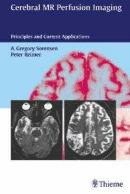 Cerebral MR Perfusion Imaging