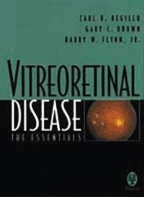 Vitreoretinal Disease