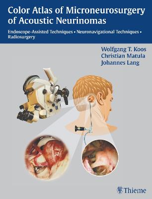 Color Atlas of Microsurgery of Acoustic Neurinomas