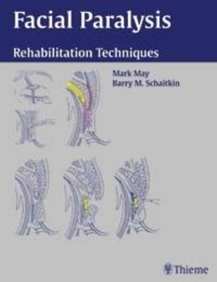 Facial Paralysis
