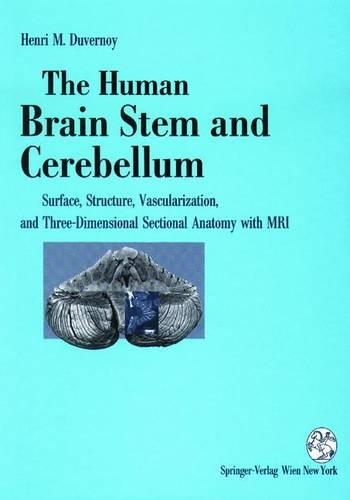 The Human Brain Stem and Cerebellum
